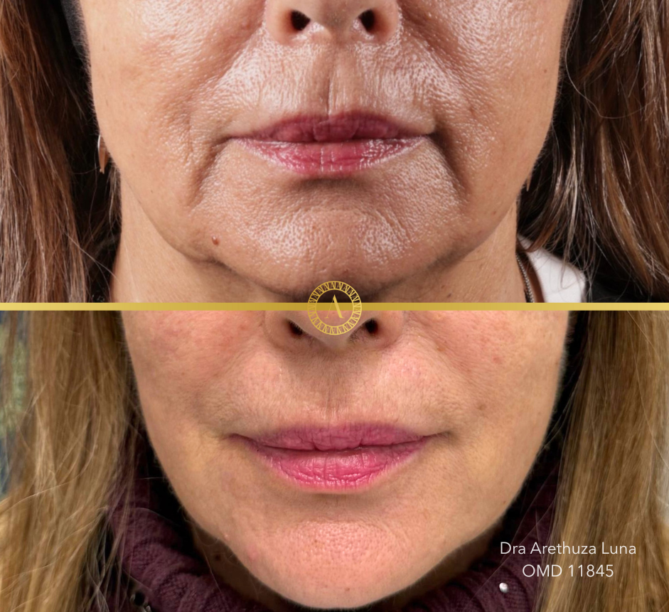 Caso 2 - Estética Facial Premium