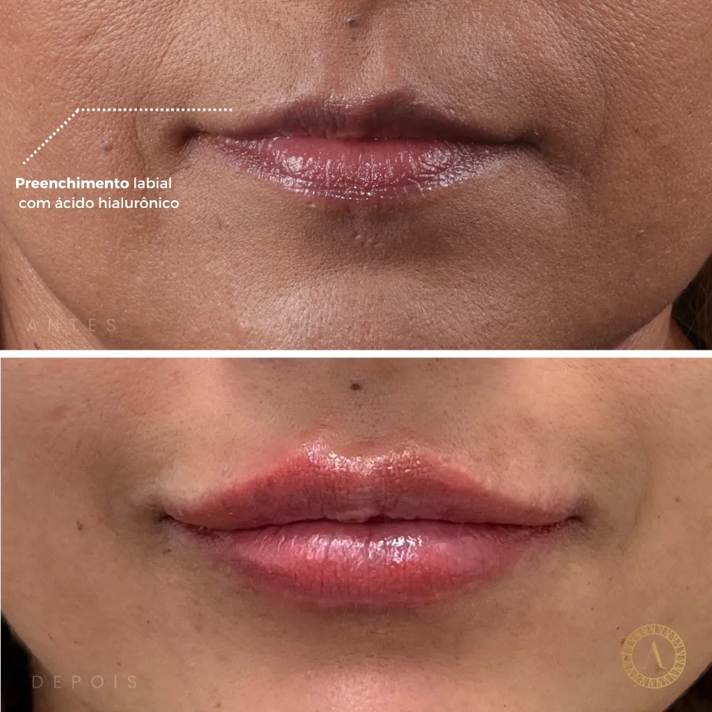 Caso 3 - Estética Facial