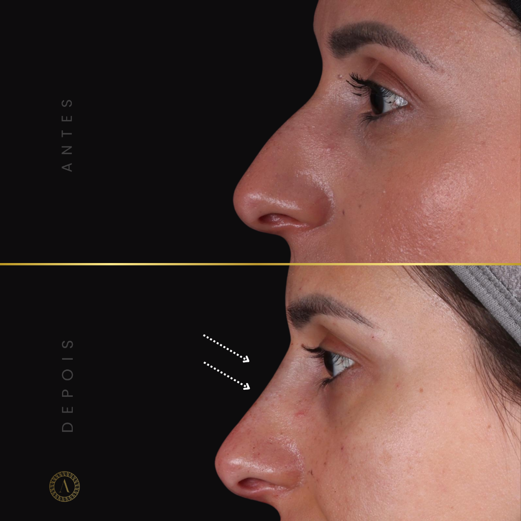 Caso 1 - Estética Facial Premium