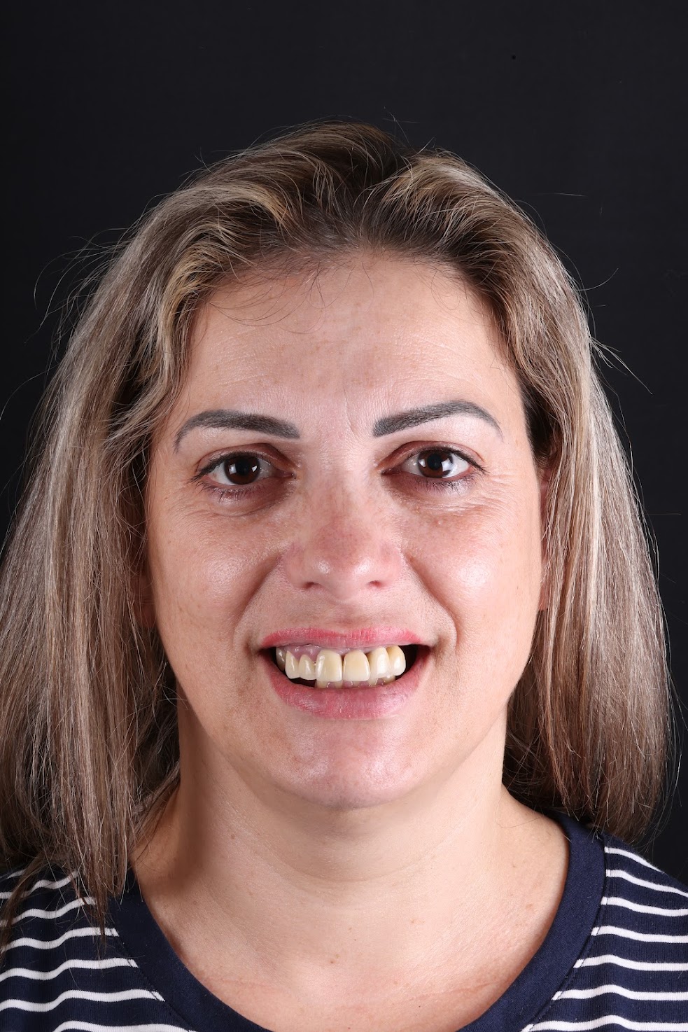 Diana Vieira antes do tratamento