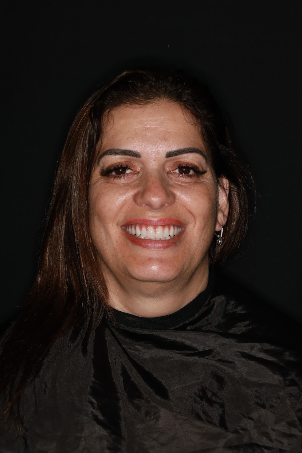 Diana Vieira após o tratamento