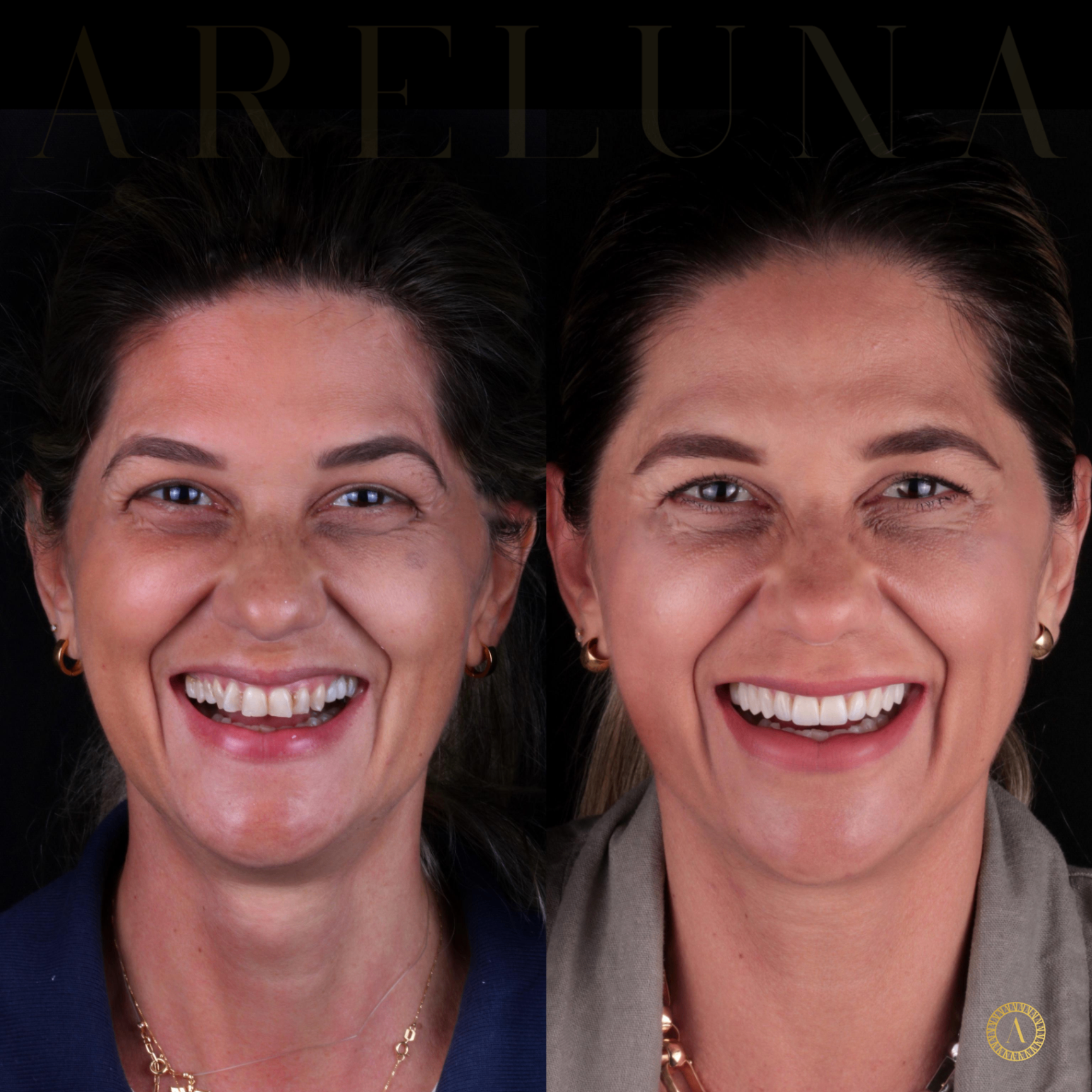 Estética Natural