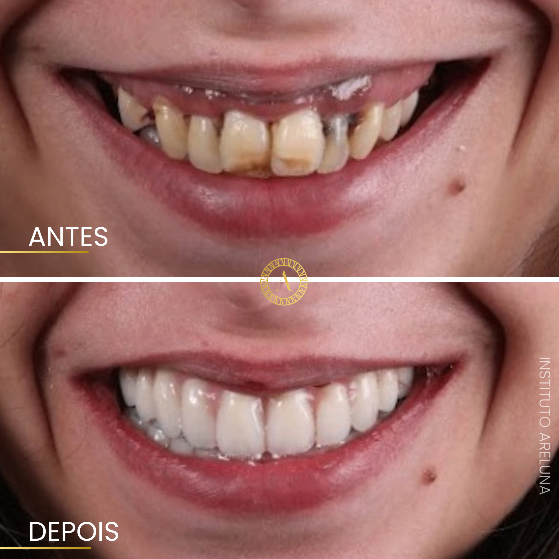 Sorriso Renovado