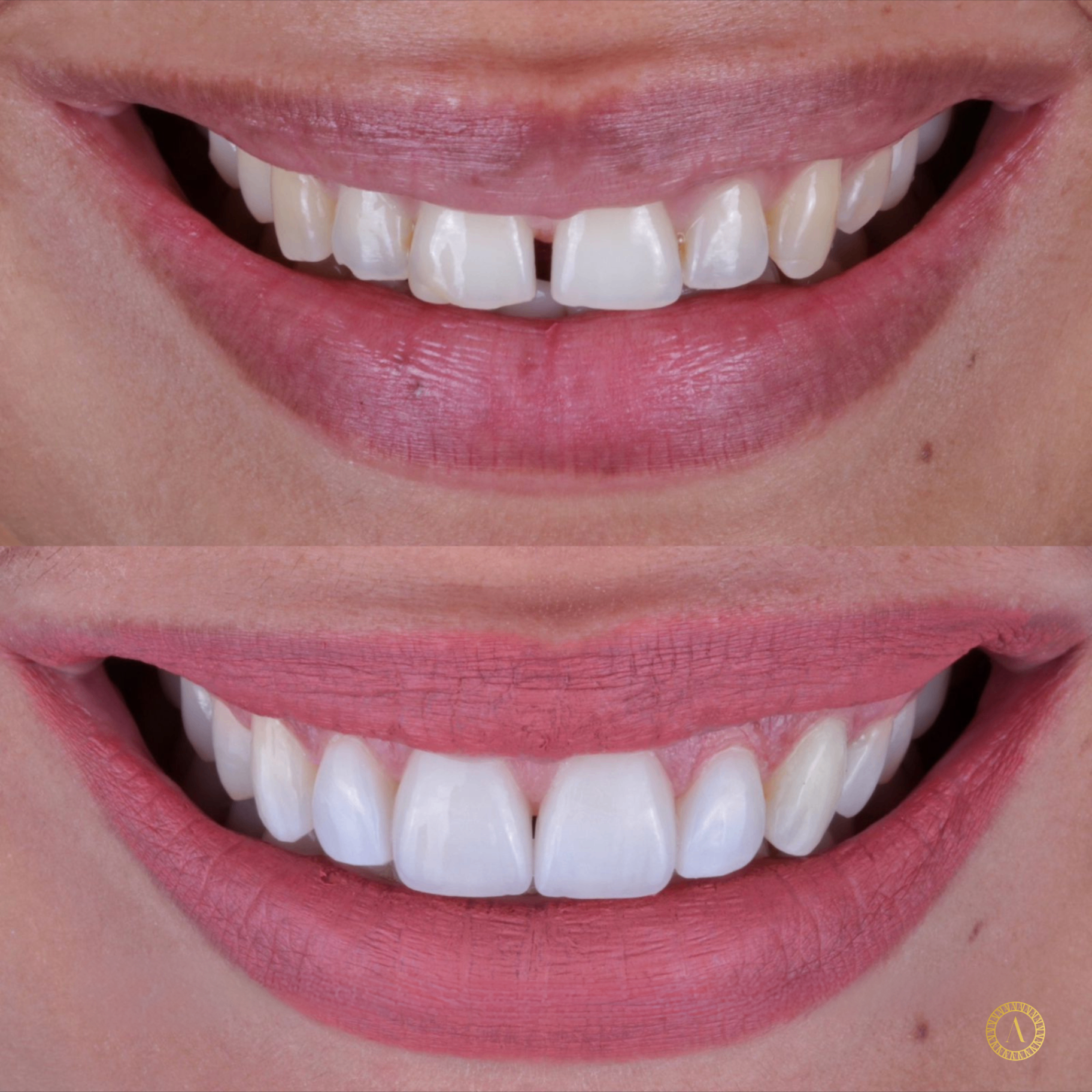 Sorriso Harmonioso